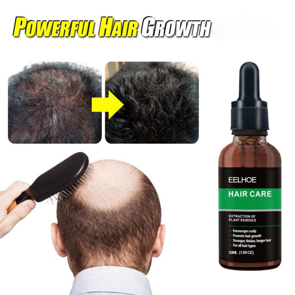1pc 10/20/30/50ml Powerful Hair Loss Hair Treatment Ginger Hair Care