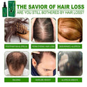 120ml Scalp Nutrient Solution Hair Conditioner Moisturizing Nutrition Strong Hair Fast Growth Hair Essence Repair Hair Care